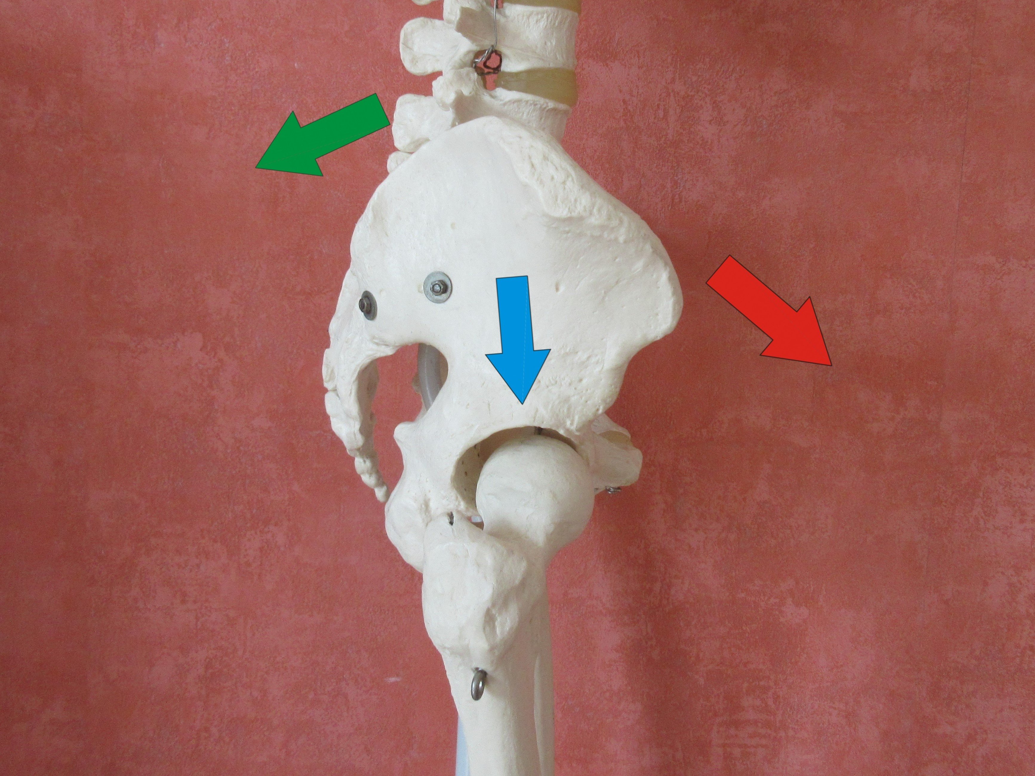 Eine nach vorn oder hinten gekippte Beckenschaufel bewirkt Beinlängendifferenzen mit Beckenschiefstand
