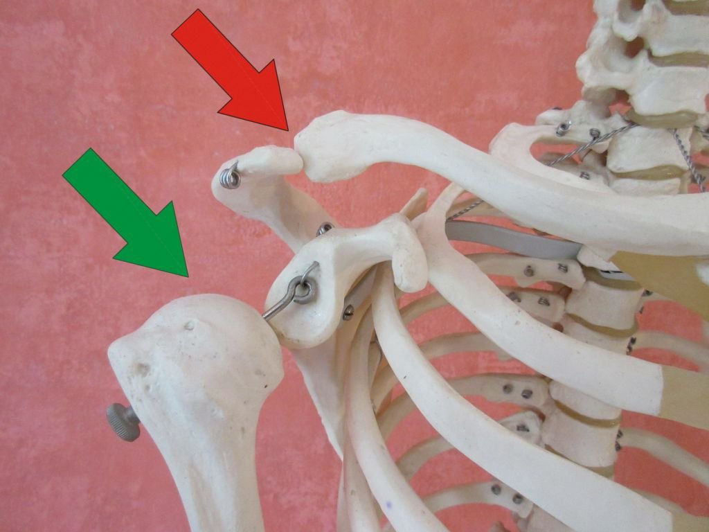 Impingement-Syndrom der Schulter - Osteopathie