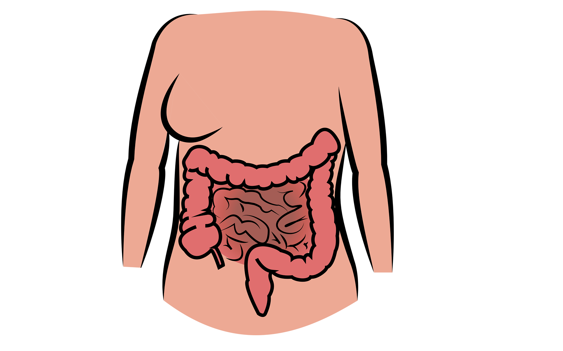 Leaky-Gut-Syndrom