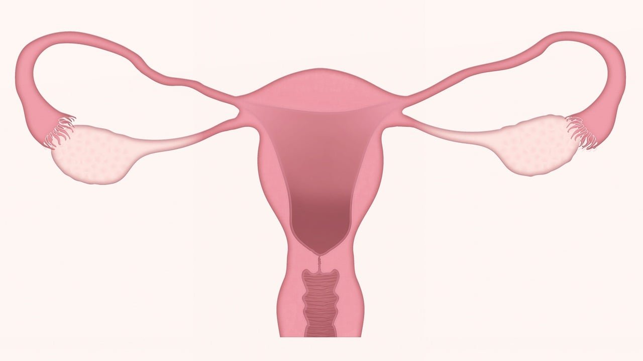 Polyzystisches Ovarialsyndrom
